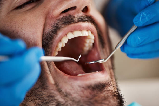 Best Walk-In Emergency Dentist in West Hazleton, PA